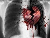 متلازمة القلب المكسور :د.علي أحمد جديد