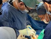 إنجاز جديد لجامعة أسيوط في عملية نادرة من نوعها لفصل تؤام ملتصق بمستشفى الأطفال الجامعي